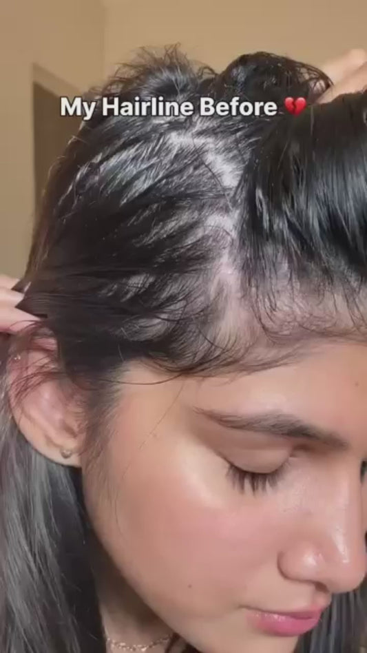 Rosemary Hair Growth Serum (Roll On) 25ml Pack of 2